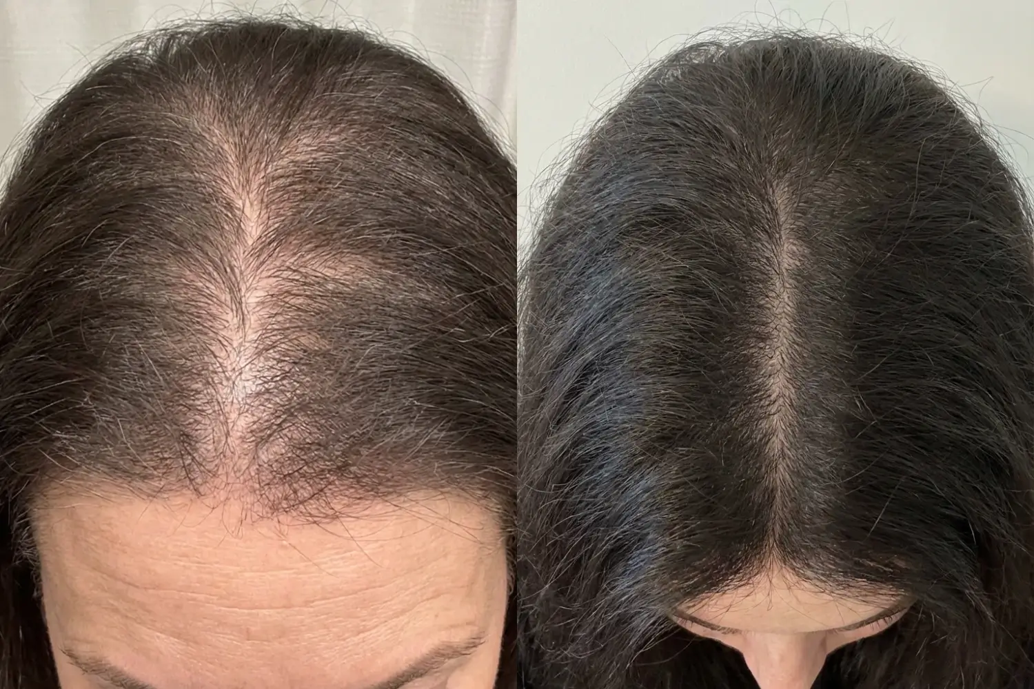 Mariam M. &mdash; before and after